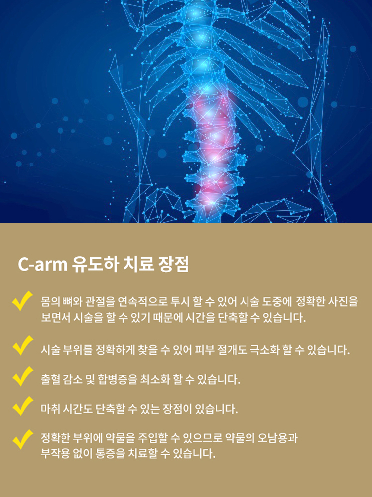 C-arm 유도하 치료